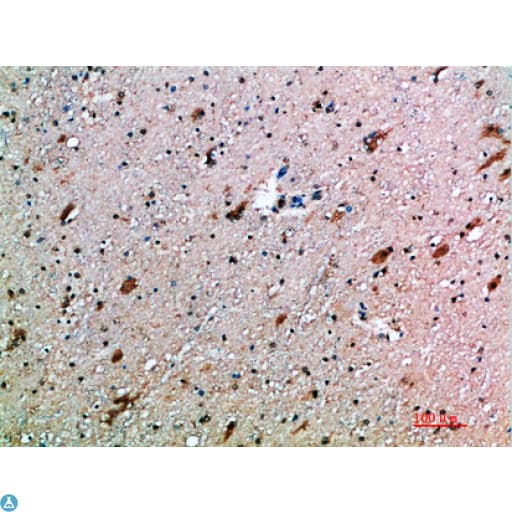 Polyclonal Rabbit anti-Human KLRK1 / CD314 / NKG2D Antibody (IHC)