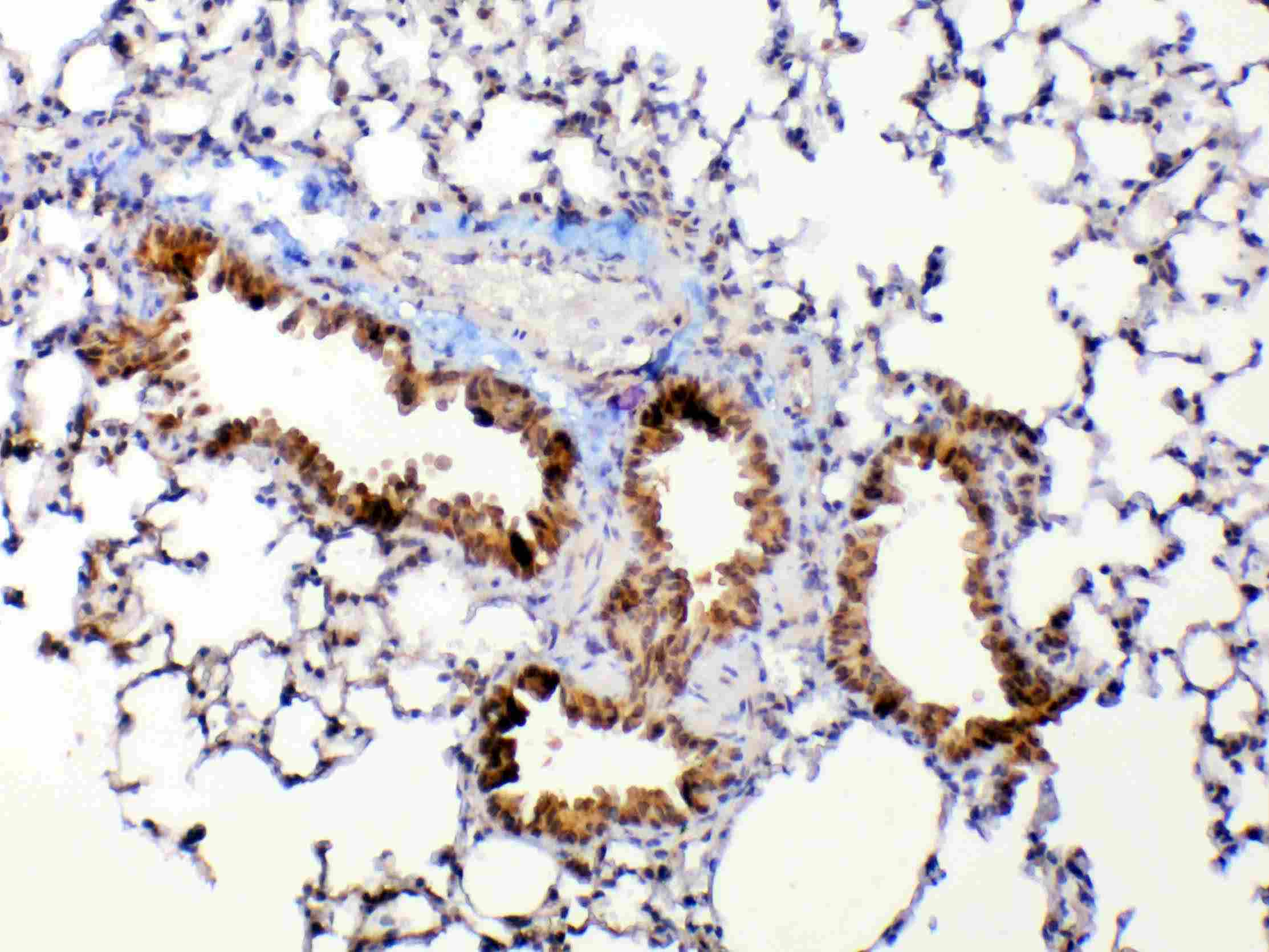 MMP13 Antibody