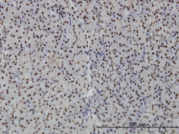 Monoclonal Mouse anti-Human PTRF / CAVIN Antibody (clone 1F7, IHC)