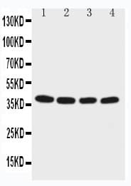 Polyclonal Rabbit anti-Human EIF2S2 Antibody (aa199-214, WB)
