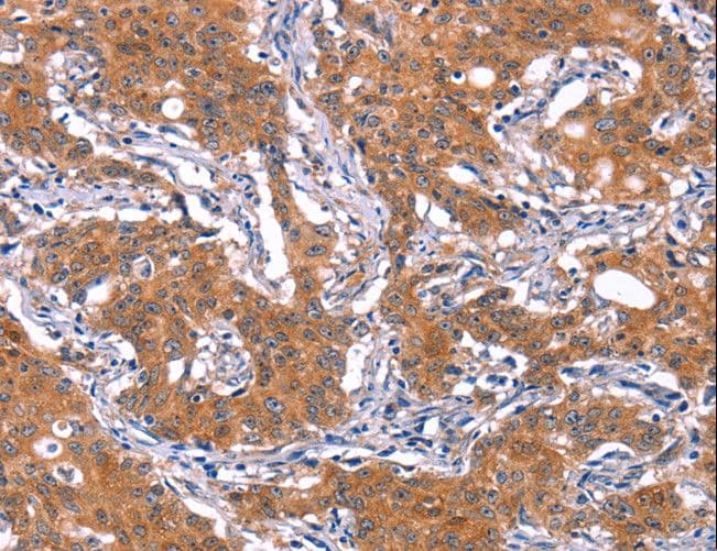 IRS1 Antibody