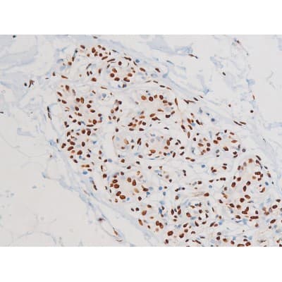 MAPK8 / JNK1 Antibody (phospho-Thr183,pTyr185)