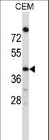 Polyclonal Rabbit anti-Human OR4C16 Antibody (aa282-310, WB)