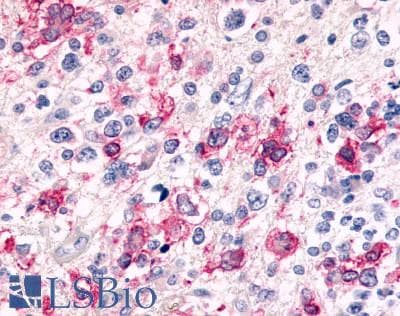 PathPlus™ CELSR3 Antibody (N-Terminus)
