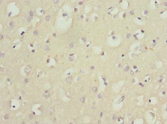 Polyclonal Rabbit anti-Human NGFRAP1 / NADE / Bex Antibody (IHC)