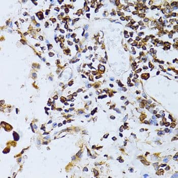 TAPBP / Tapasin Antibody