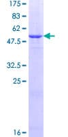 Human NT5E / eNT / CD73 Protein (Recombinant GST)