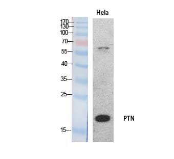 PTN / Pleiotrophin Antibody