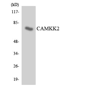 IHC-plus™ Polyclonal Rabbit anti-Human CAMKK2 Antibody (aa374-423, IHC, WB)