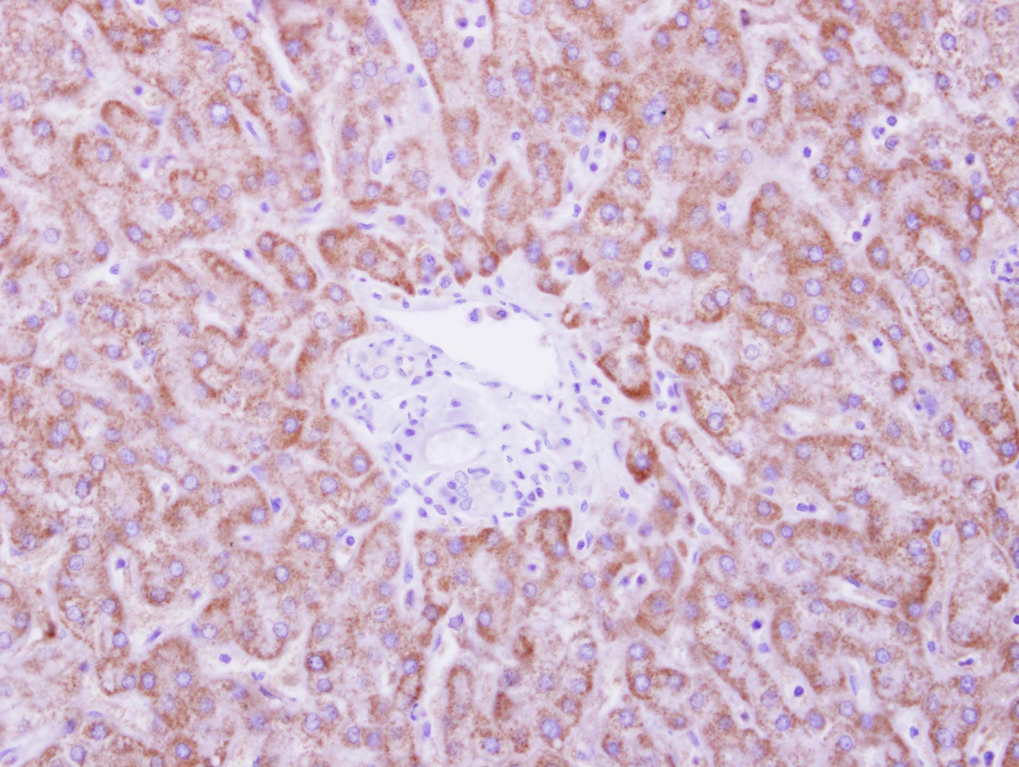 Polyclonal Rabbit anti-Human ANKRD45 Antibody (aa74-282, IHC, WB)