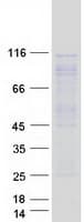 Human ARHGEF2 / GEF-H1 Protein (Recombinant Myc-DDK (Flag))