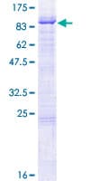 Human BIRC2 / cIAP1 Protein (Recombinant GST)