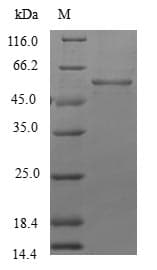 Human LFNG / Lunatic Fringe Protein (Recombinant GST, N-terminus)