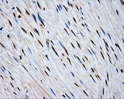 Monoclonal Mouse anti-Human MCL1 / MCL 1 Antibody (clone OTI9C9, IHC, IF, WB)