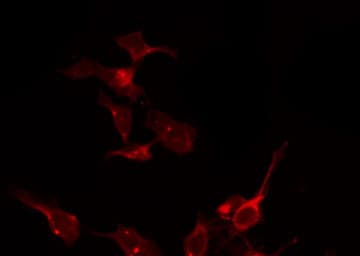FOLR1 / Folate Receptor Alpha Antibody
