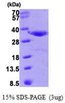 Human ANXA4 / Annexin IV Protein (Recombinant)