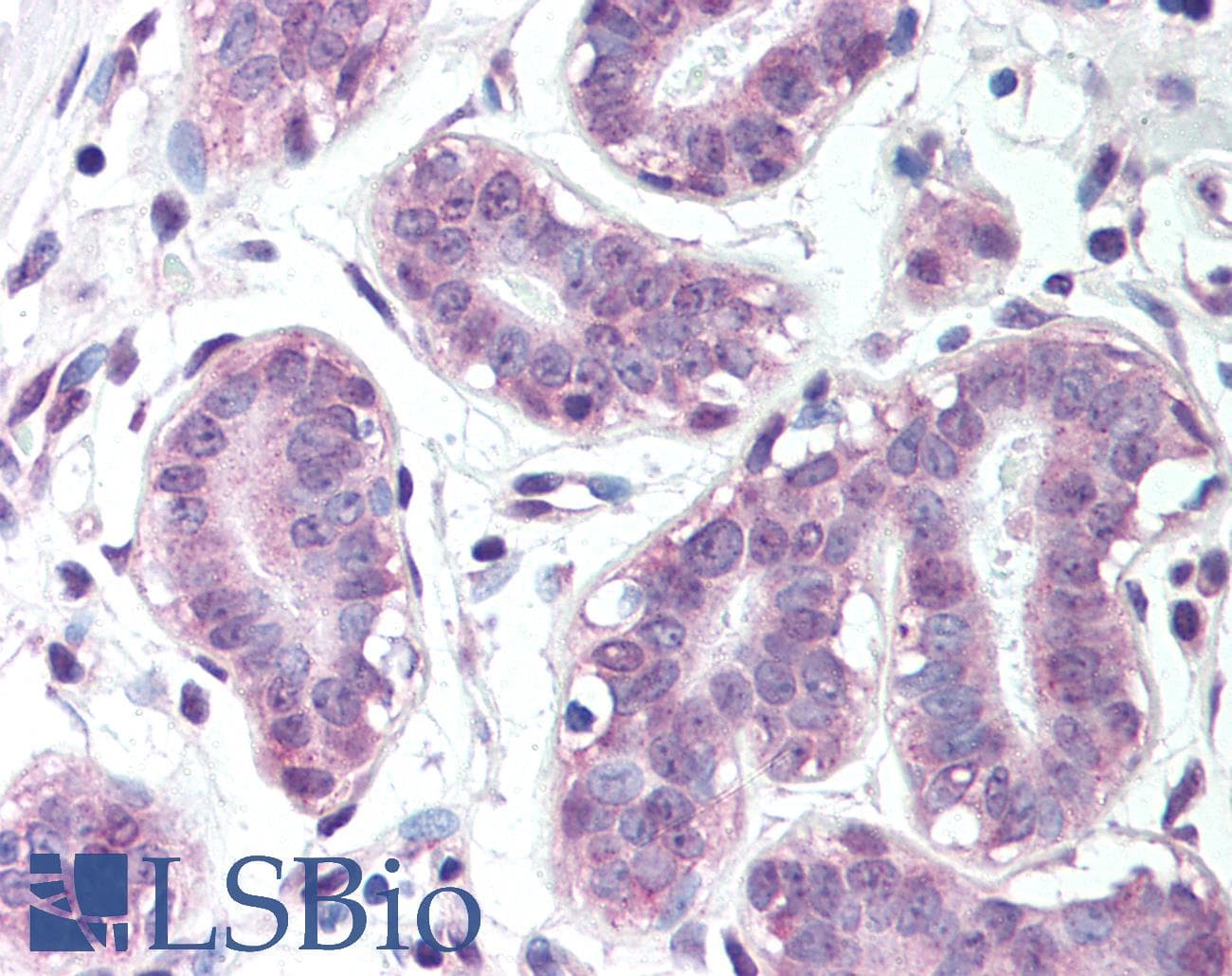 IHC-plus™ Polyclonal Rabbit anti-Human BRCA1 Antibody (Ser1423, IHC, WB)