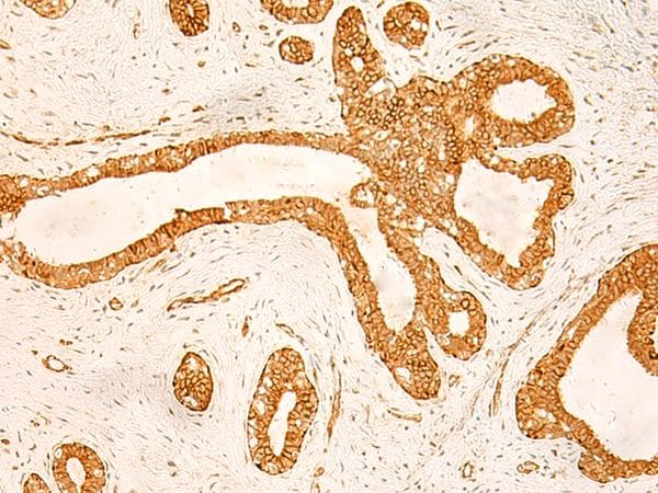 KRT76 / Keratin 76 Antibody