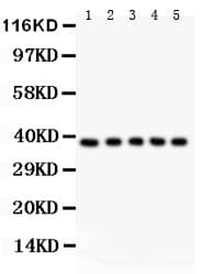 CD95 / FAS Antibody (aa26-173)