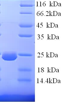 Human Dystonin / BPAG1 Protein (Recombinant His)