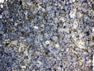 Polyclonal Rabbit anti-Human SNRPN Antibody (IHC, WB)
