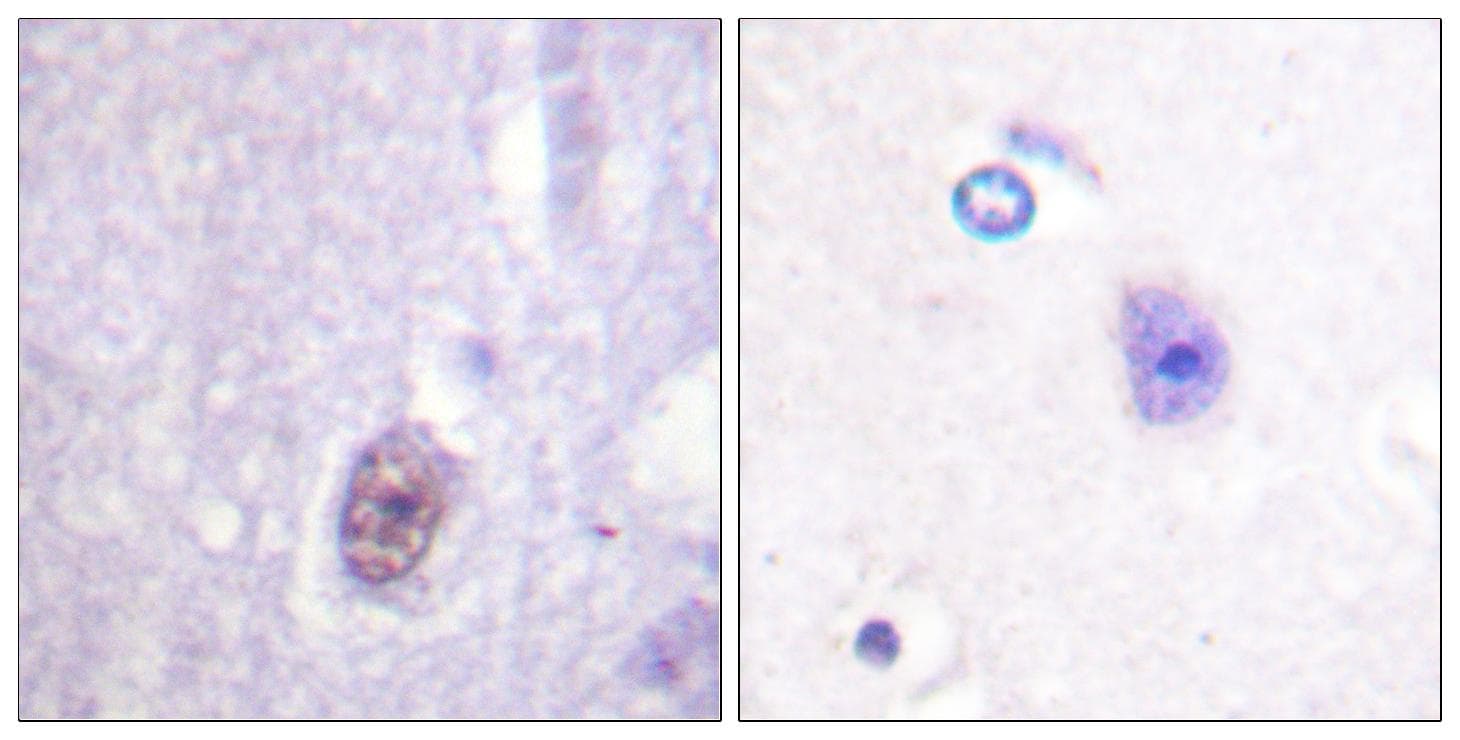SP1 Antibody (phospho-Thr453)