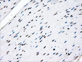 HDAC10 Antibody (clone OTI3C2)
