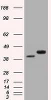 Basigin / Emmprin / CD147 Antibody (clone OTI9H5)