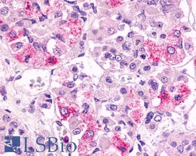 PathPlus™ Polyclonal Rabbit anti-Human FKSG80 / GPR81 Antibody (Extracellular Domain, IHC)
