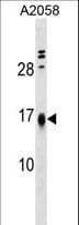 LBH Antibody (aa26-53)
