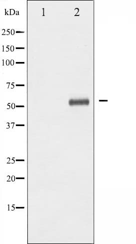 p56lck / LCK Antibody (phospho-Tyr393)