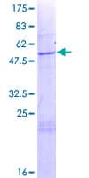 Human CTMP / THEM4 Protein (Recombinant GST)