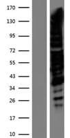 TRPS1 Protein (Over-Expression Lysate Myc-DDK (Flag))