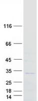 Human RAB40A / RAR2 Protein (Recombinant Myc-DDK (Flag))