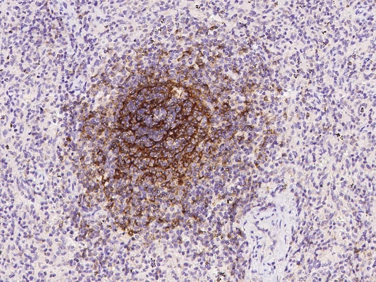 CR2 / CD21 Antibody