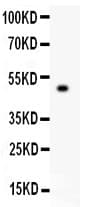 Polyclonal Rabbit anti-Human TJP1 / ZO-1 Antibody (aa1178-1527, IHC, WB)