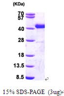 Human SORD / Sorbitol Dehydrogenase Protein (Recombinant His)
