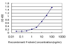 DPH2 Antibody (clone 5B10)