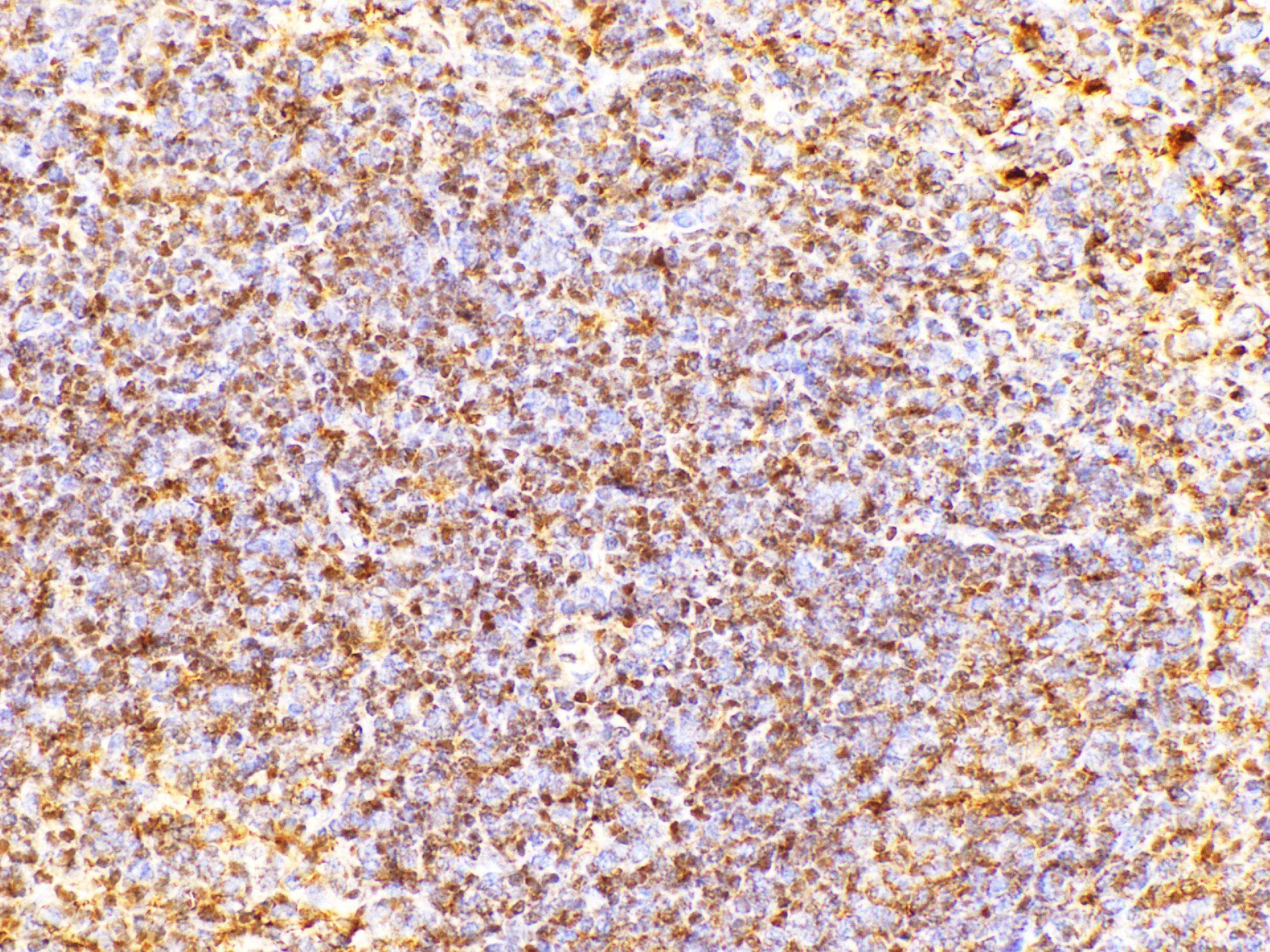 Polyclonal Rabbit anti-Mouse CD38 Antibody (IHC, WB)