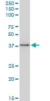 IHC-plus™ BAG1 / BAG-1 Antibody (clone 2D3)