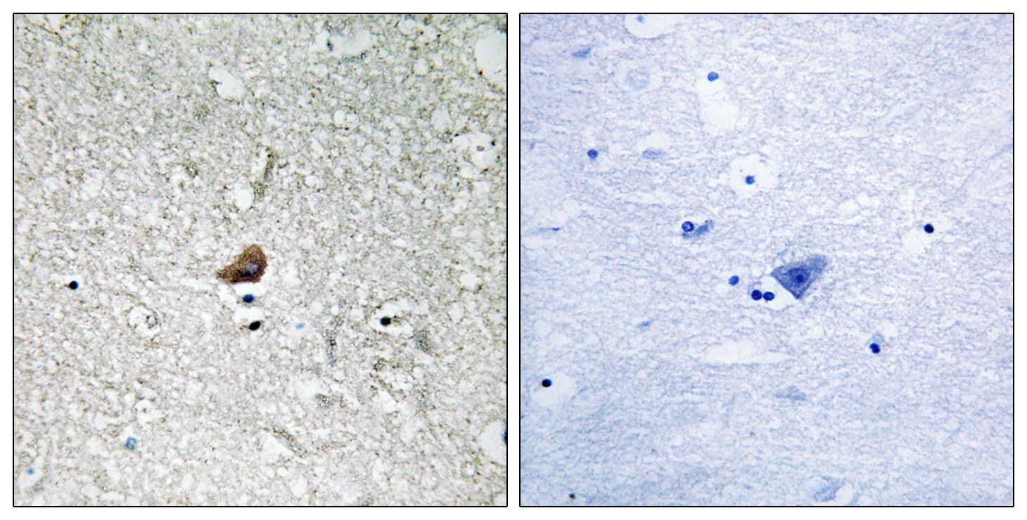 IRAK1 / IRAK Antibody (aa342-391)