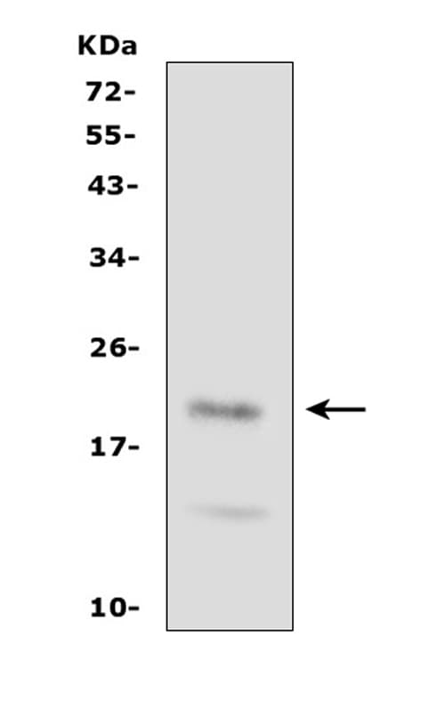 Polyclonal Rabbit anti-Human FGF21 Antibody (aa43-58, WB)