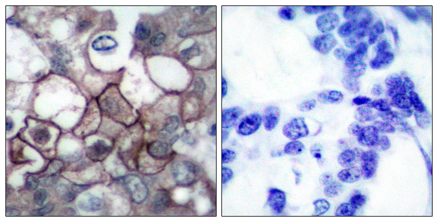 EGFR Antibody (phospho-Tyr1197)