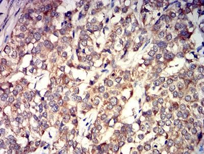 GRIK4 / KA1 Antibody (clone 8H5H9)