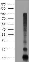 Monoclonal Mouse anti-Human FXYD3 Antibody (clone OTI1E8, IHC, IF, WB)