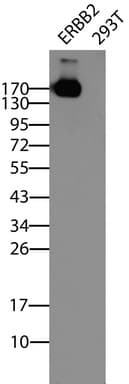 ERBB2 / HER2 Antibody (aa676-1255, clone UMAB33, Carrier-free)