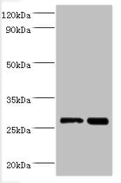 IHC-plus™ LGALS3 / Galectin 3 Antibody (aa2-250)