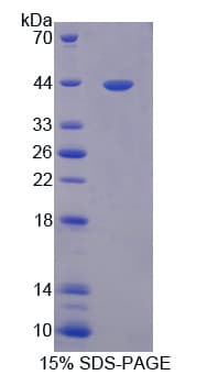 Human OAS2 Protein (Recombinant His)