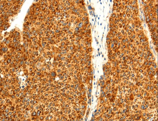 DIABLO / SMAC Antibody