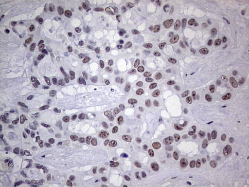 TLK2 Antibody (aa1-296, clone OTI2C1)